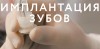 Имплантация зубов в стоматологической клинике "Дентамед"